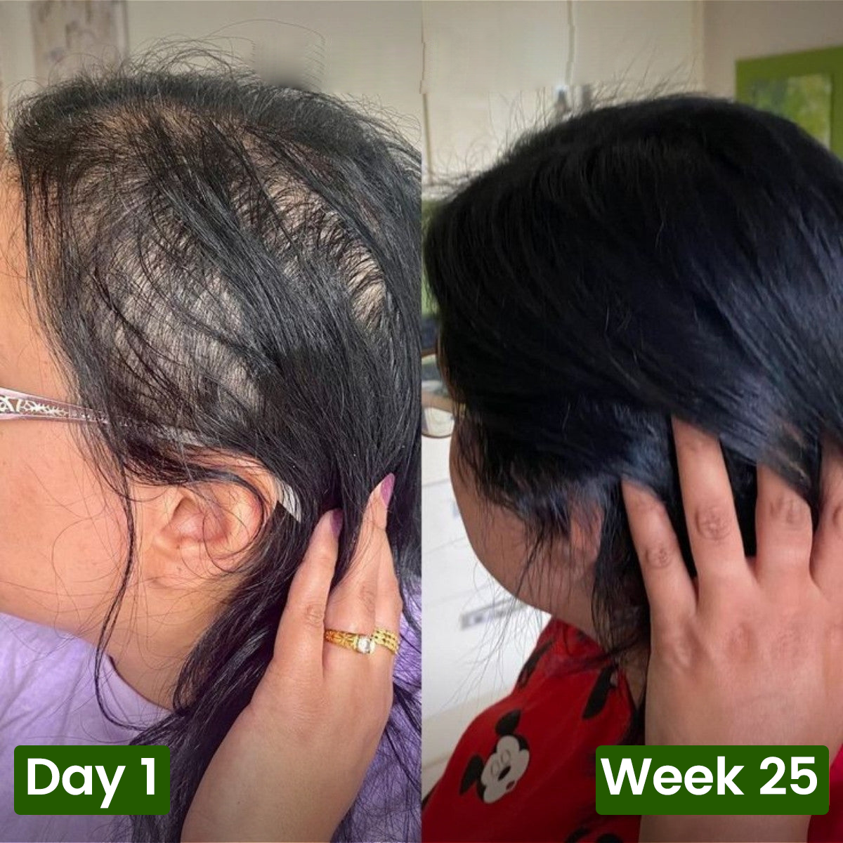 Nutrive© Pumpkin Seed Oil Softgel