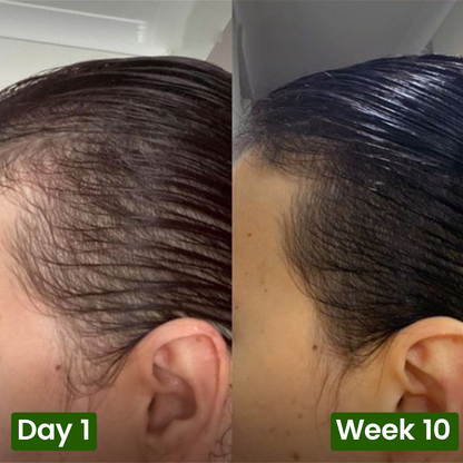 Nutrive© Pumpkin Seed Oil Softgel