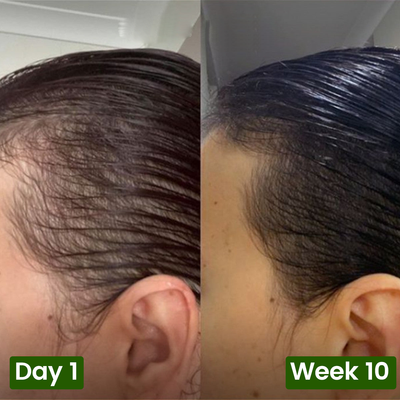 Nutrive© Pumpkin Seed Oil Softgel