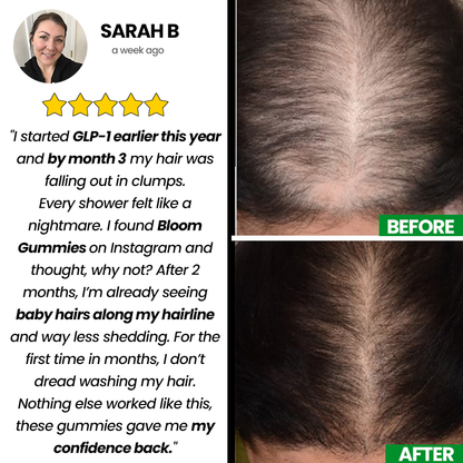 Nutrive© Sea Moss & Pearl Powder Gummies