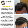 Nutrive© Hair Roll-On Serum